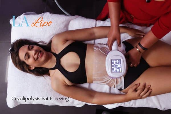 woman getting cryolipolysis Crewe