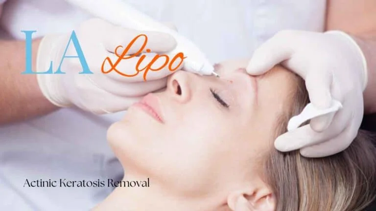 Woman receiving Actinic Keratosis Removal Treatment Crewe