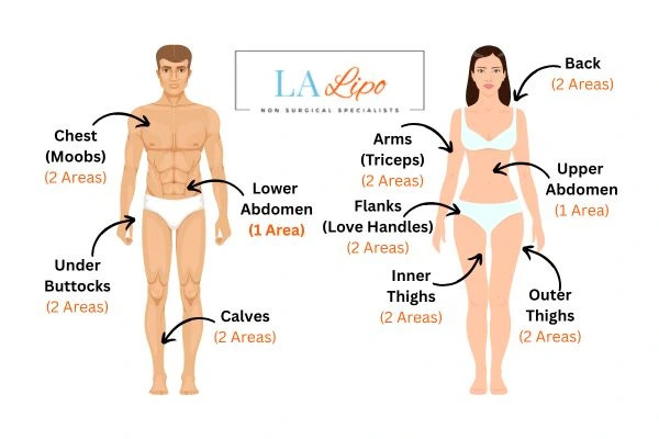 LA LIPO Cryolipolysis Areas Crewe