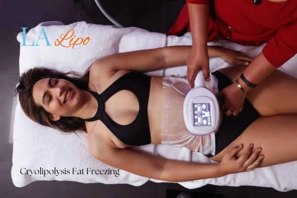woman getting cryolipolysis Crewe