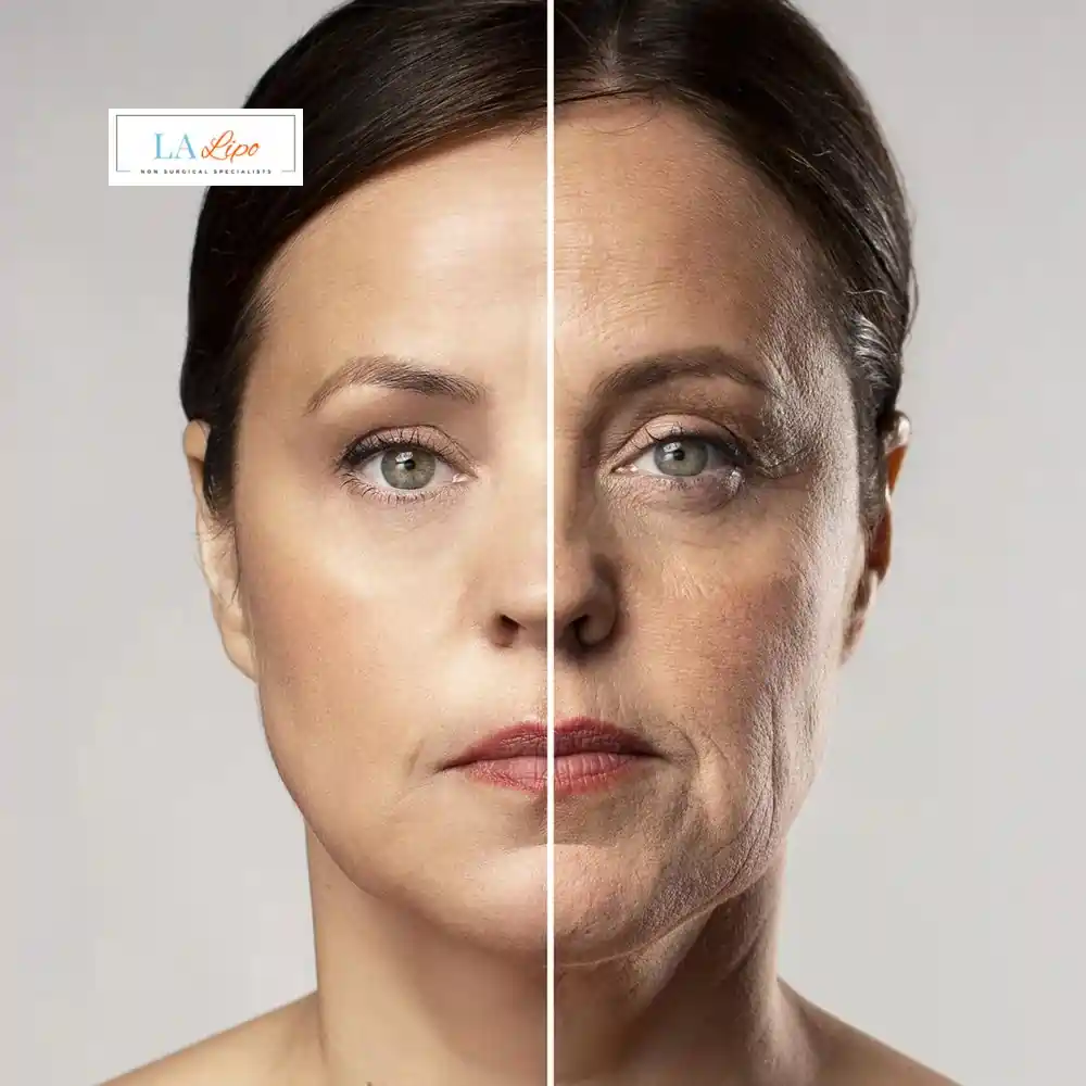 How Can You Tell If Non-Surgical Skin Tightening Is Right for You Crewe?