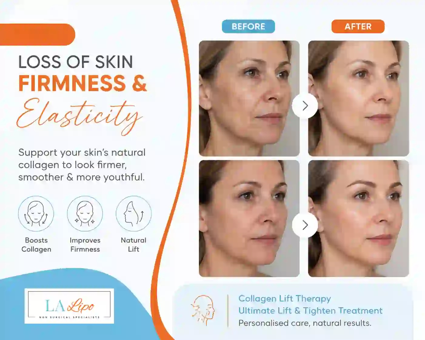 Sign #7: Loss of Skin Firmness and Elasticity Crewe